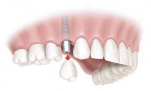 Catarroja Clínica Dental Odontología Dentista Odontólogo