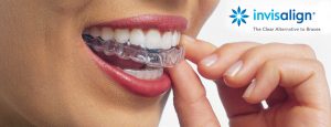 Catarroja Clínica Dental Odontología Dentista Odontólogo invisalign