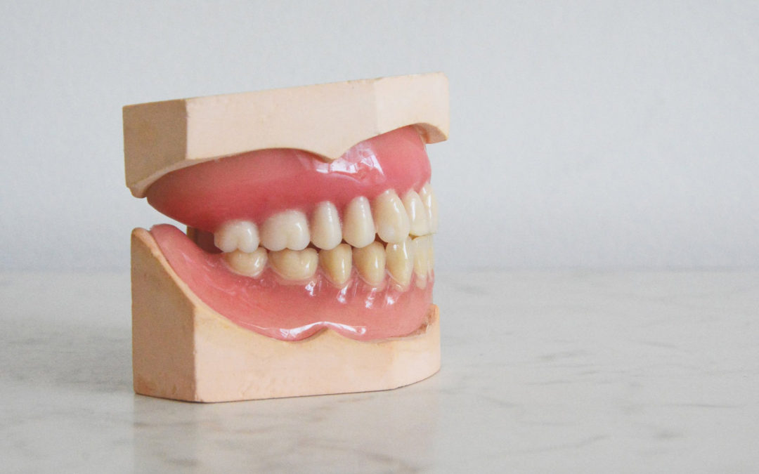 Cómo tratar la mordida abierta